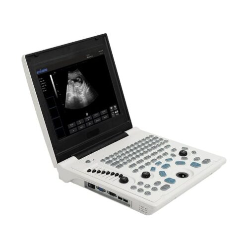 Machine d'échographie N/B portable pour les échographies obstétricales et gynécologique